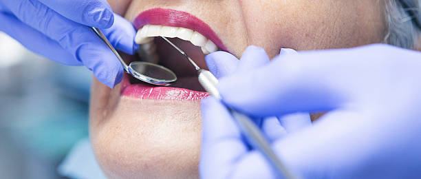 Best Lost Filling or Crown Replacement in Clinton, LA